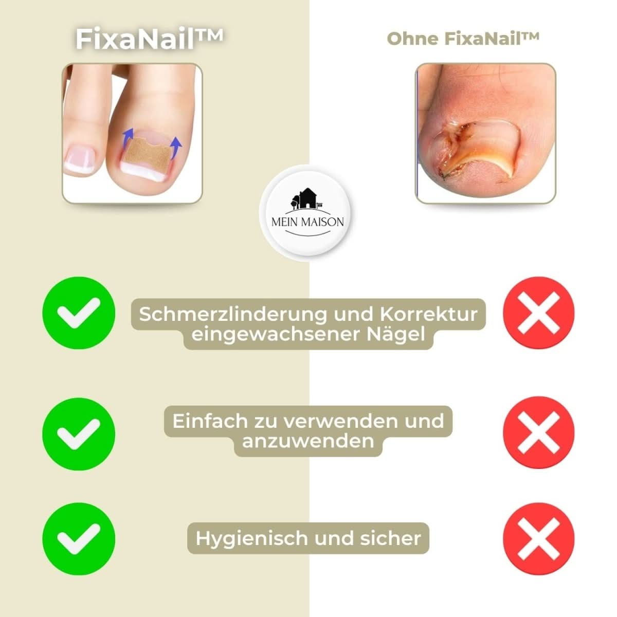 NovaNail Gentle Nail Correction for Ingrown Nails and Pain | Temsk