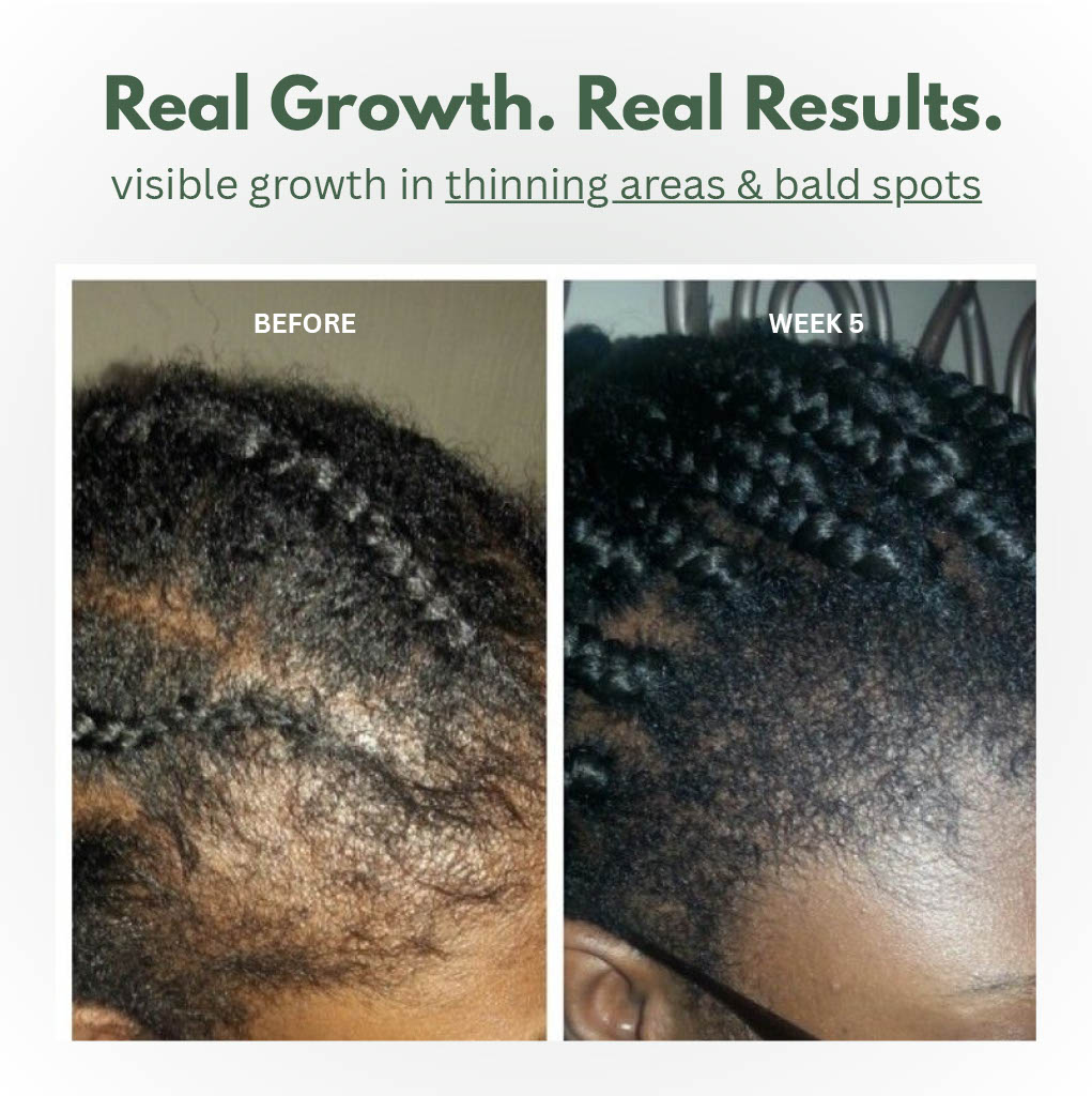 Batana Scalp Serum for Hair & Scalp Care | Temsk