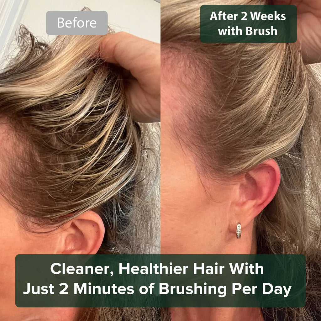 Scalp Massage and Cleansing Brush | Temsk