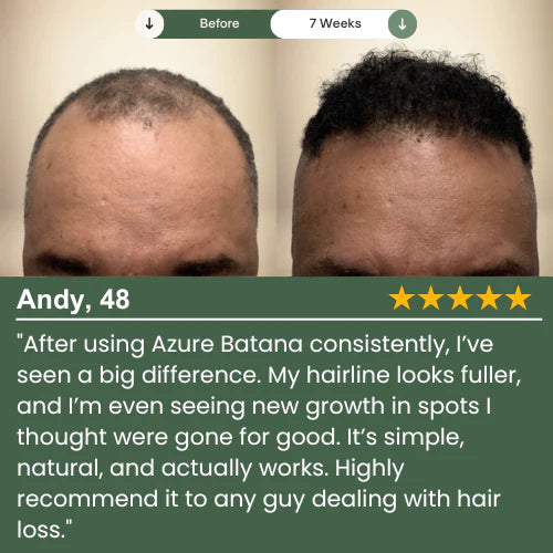 Batana Scalp Serum for Hair & Scalp Care | Temsk