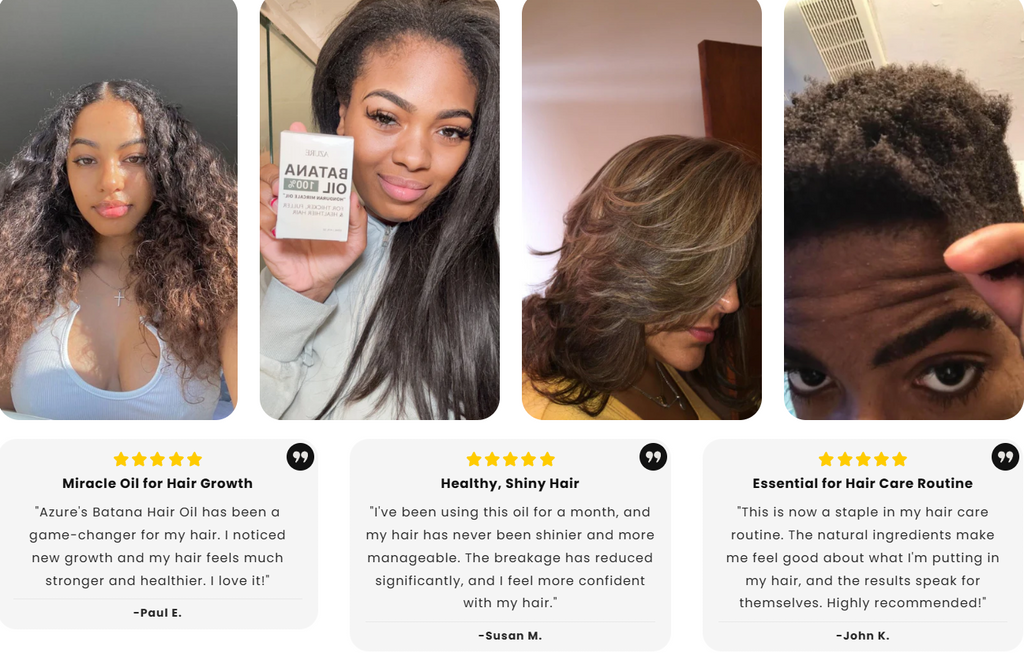 Batana Scalp Serum for Hair & Scalp Care | Temsk