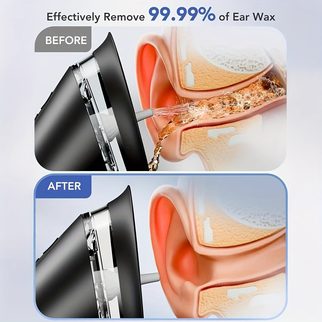 USB Rechargeable Ear Wax Cleaner With Water System | Temsk
