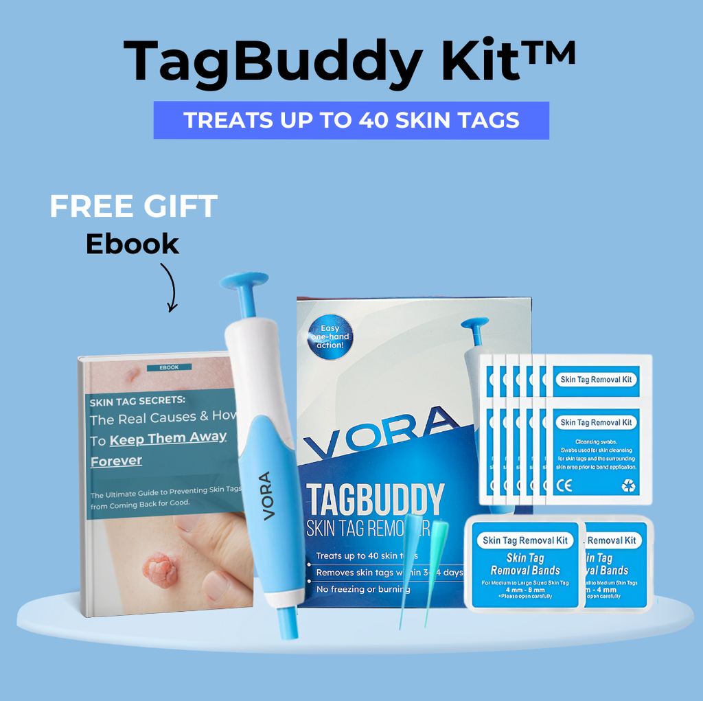 Skin Tag Removal Kit with Micro-Compression Bands | Temsk