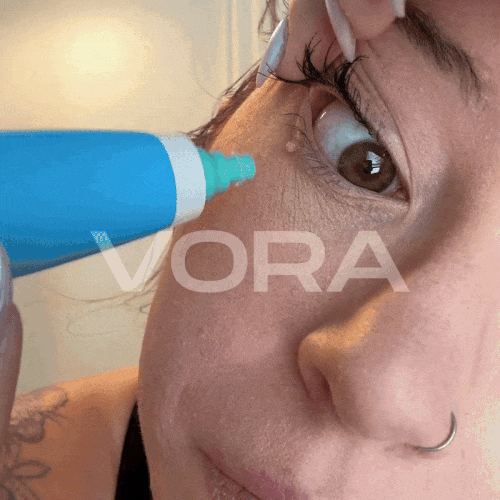Skin Tag Removal Kit with Micro-Compression Bands | Temsk