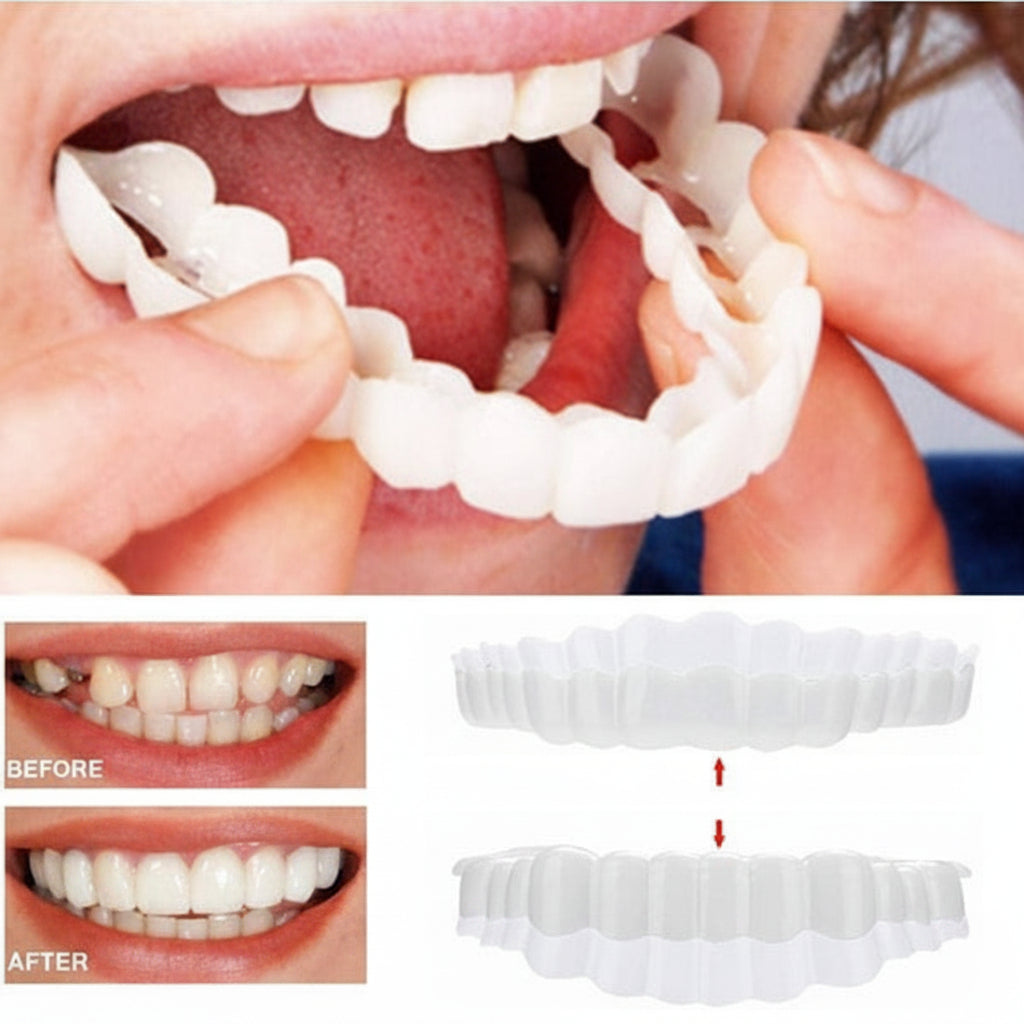 Natural Looking Removable Smile Veneers For Uneven Teeth | Temsk