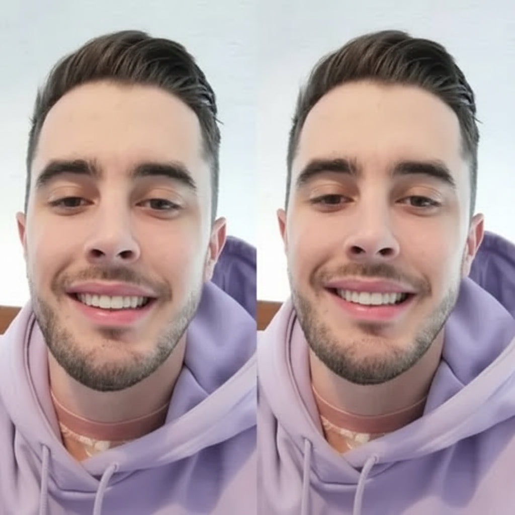 Natural Looking Removable Smile Veneers For Uneven Teeth | Temsk